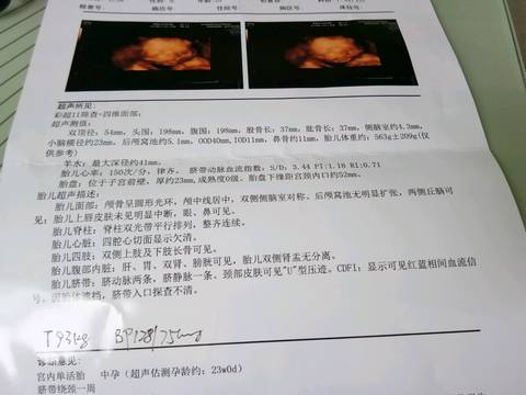journal_insert_pic_1027333341
