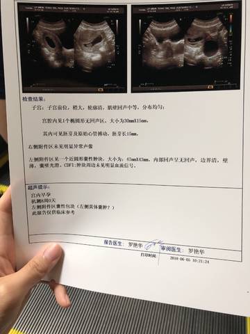 journal_insert_pic_1028023147