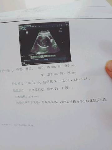 journal_insert_pic_1028734976