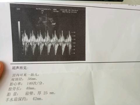 journal_insert_pic_1029571606
