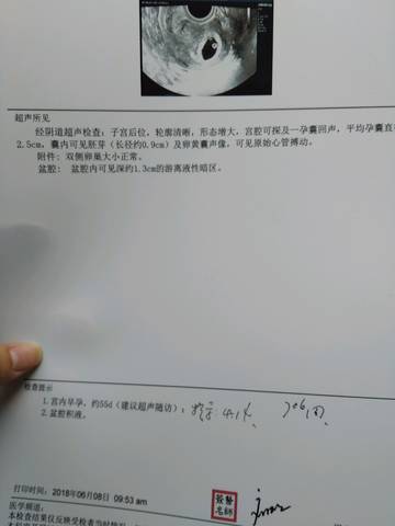 journal_insert_pic_1030169888