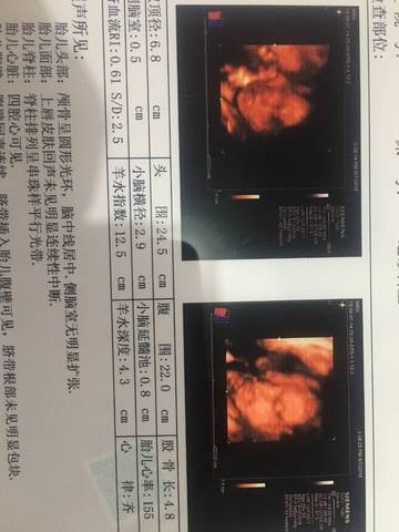 journal_insert_pic_1030804806