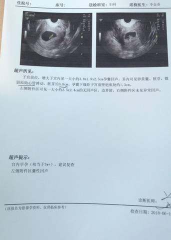 journal_insert_pic_1031744015