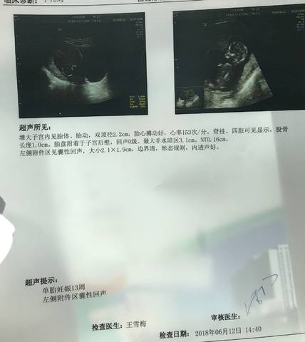 journal_insert_pic_1033325881