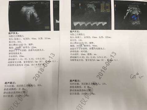 journal_insert_pic_1034189562