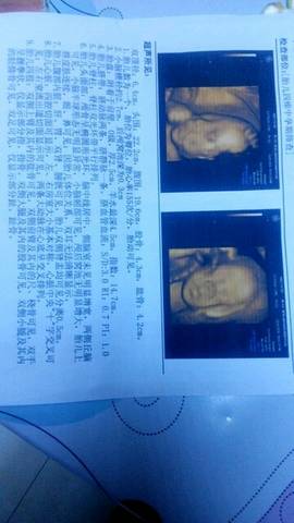 journal_insert_pic_1034044891