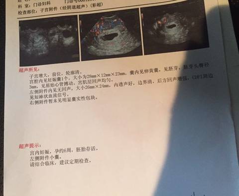 journal_insert_pic_1033618213