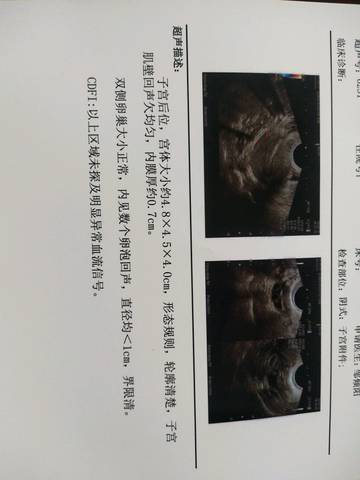journal_insert_pic_1035368762