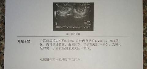 journal_insert_pic_1035575275