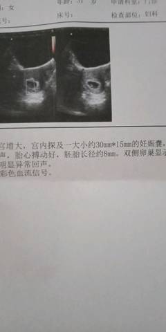 journal_insert_pic_1038158875
