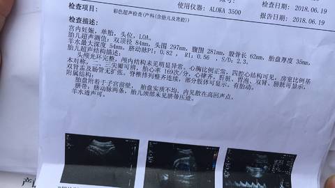 journal_insert_pic_1037852151
