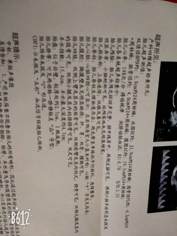 journal_insert_pic_1037693351