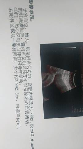 journal_insert_pic_1038804037
