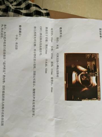 journal_insert_pic_1040005798