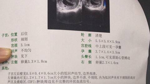 journal_insert_pic_1040260839