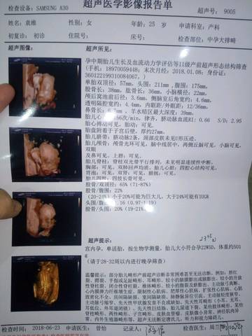 journal_insert_pic_1040918334