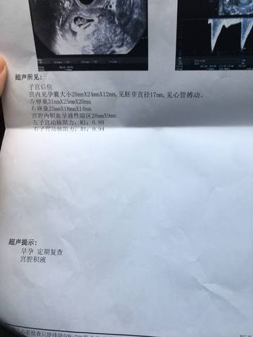 journal_insert_pic_1041457184