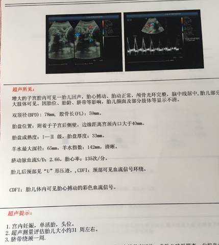 journal_insert_pic_1041439619