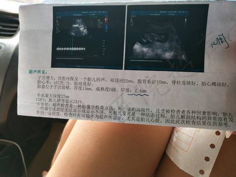 journal_insert_pic_1041915456