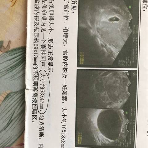 journal_insert_pic_1046506953