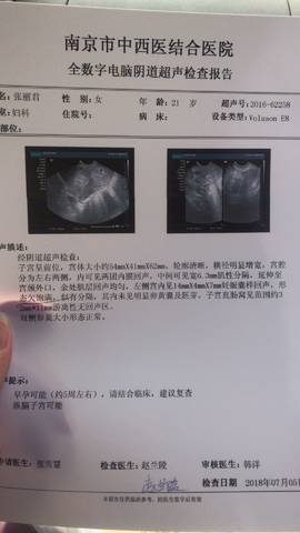 journal_insert_pic_1048640238