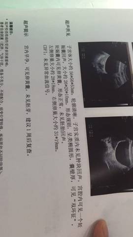 journal_insert_pic_1048887573