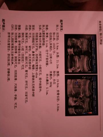 journal_insert_pic_1049095735
