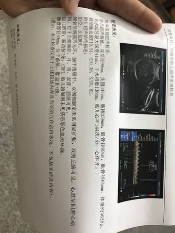 journal_insert_pic_1049712569