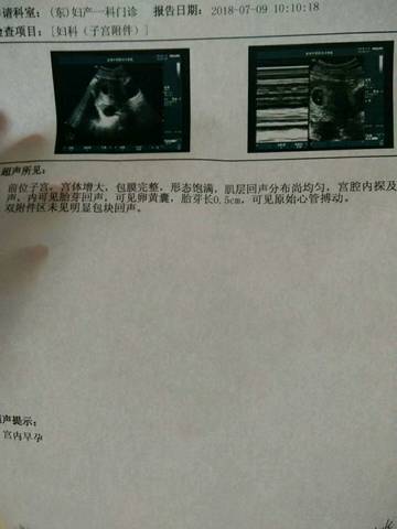 journal_insert_pic_1052926279