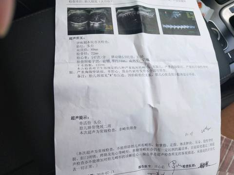 journal_insert_pic_1053748239