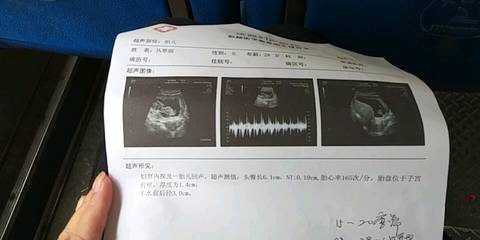journal_insert_pic_1054234597