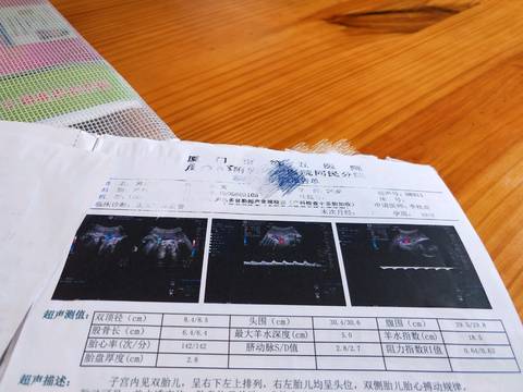 journal_insert_pic_1054176849