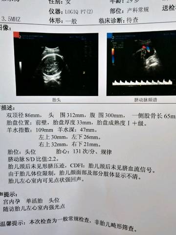 journal_insert_pic_1056870744