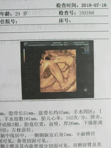 journal_insert_pic_1057401067