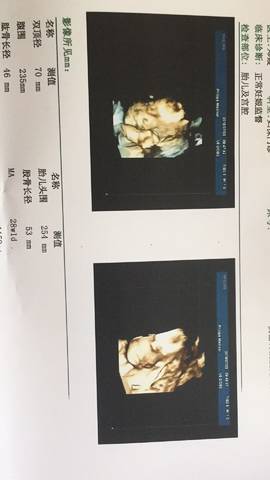journal_insert_pic_1059811645