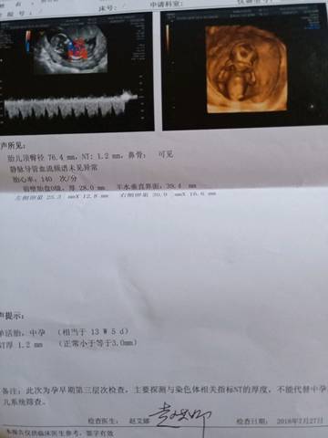 journal_insert_pic_1062409822