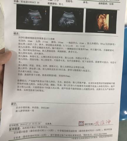 journal_insert_pic_1062395601
