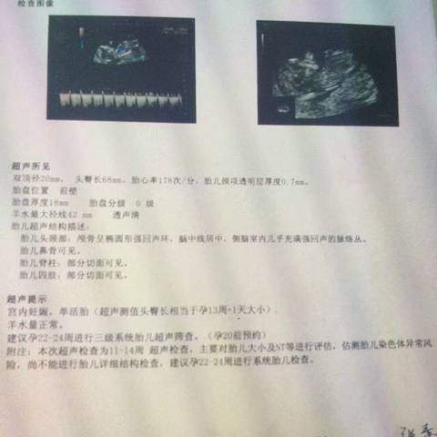 journal_insert_pic_1062623069