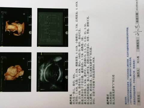 journal_insert_pic_1066975368