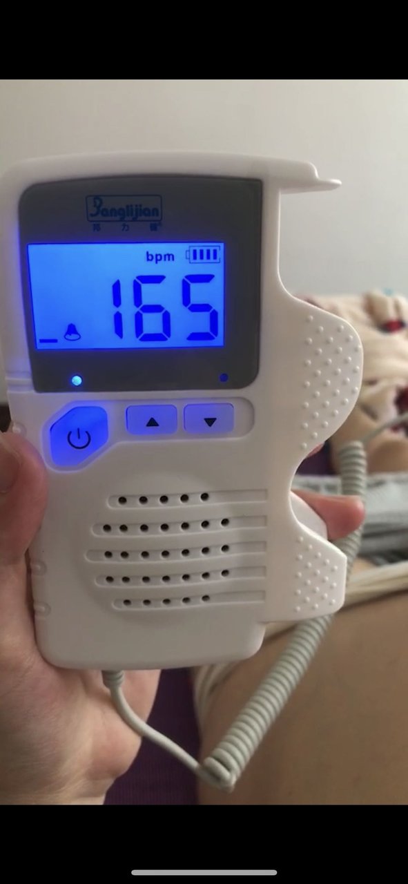 孕15周胎心