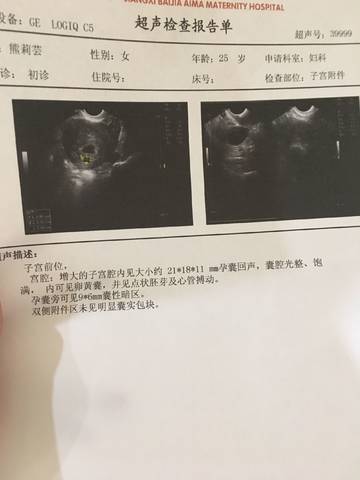 journal_insert_pic_1067465459