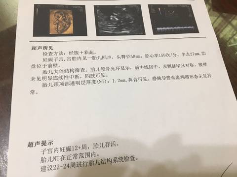 journal_insert_pic_1067374764