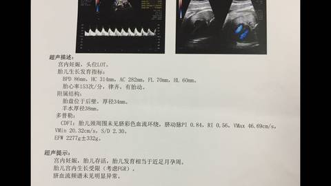 journal_insert_pic_1067419167