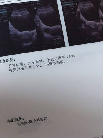 journal_insert_pic_1068220807