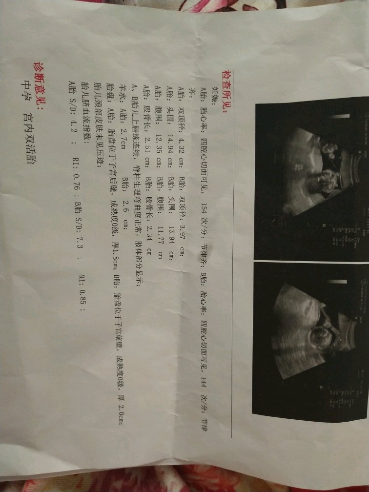 17周，帮我看看这个宝宝脐血流指数不正常样！