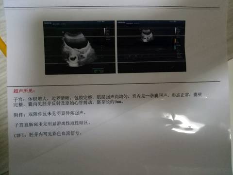 journal_insert_pic_1069735320