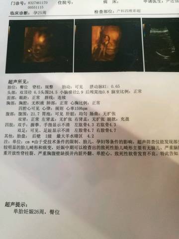 journal_insert_pic_1070220079