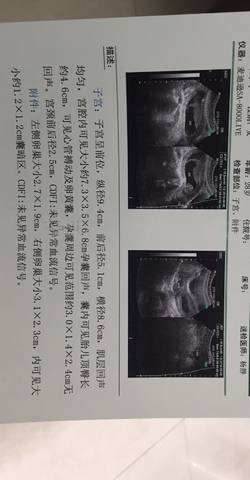 journal_insert_pic_1069983580