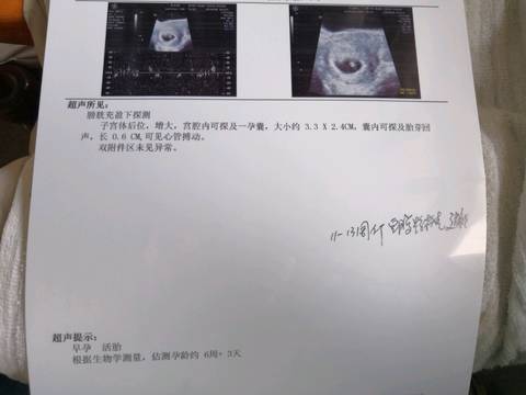 journal_insert_pic_1070857443