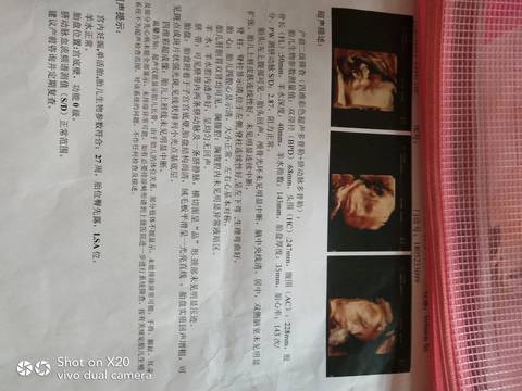 journal_insert_pic_1070797299